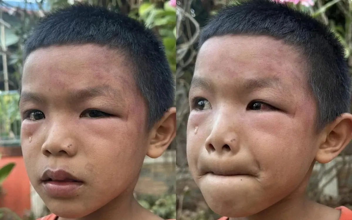 Mutiger isaan held rettet siebenjaehrigen allein lebenden jungen aus prekaeren verhaeltnissen in 6e1d3039