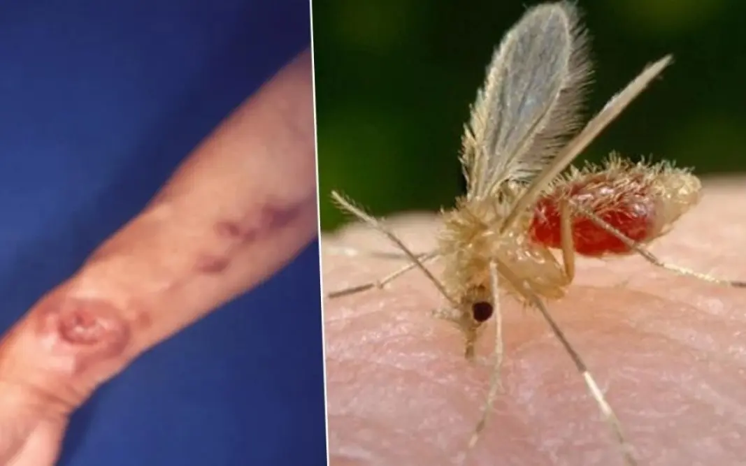 Sandfliegen uebertragen toedliche parasiten 8abcba93