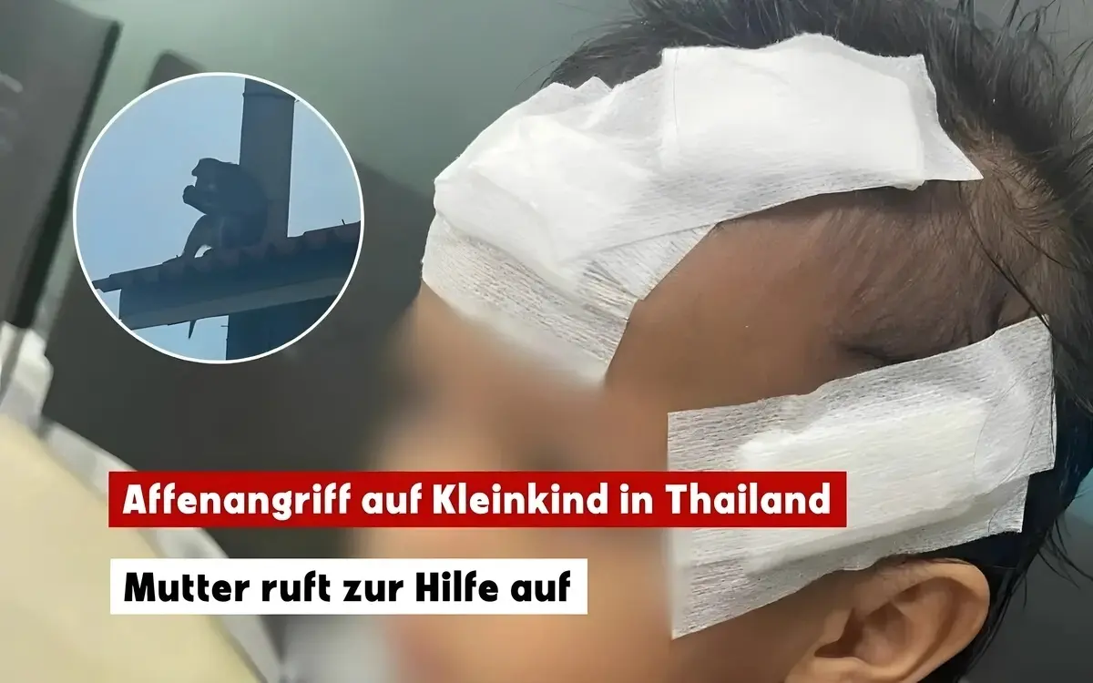 Thailaendische mutter bittet um hilfe nachdem affen ihre tochter gebissen haben 3d4b13f6