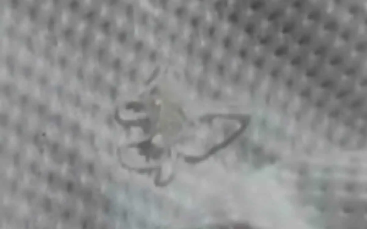 Thailaendischer albtraum herzwurm kriecht aus frauengesicht video 6db4f559
