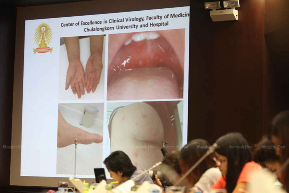 Alarm in Thailand! Mysteriöse Kinder-Krankheit breitet sich rasant aus