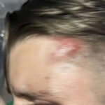 Deutscher in Pattaya attackiert - Holländer in Phuket verletzt Deutscher in Pattaya attackiert - Holländer in Phuket verletzt