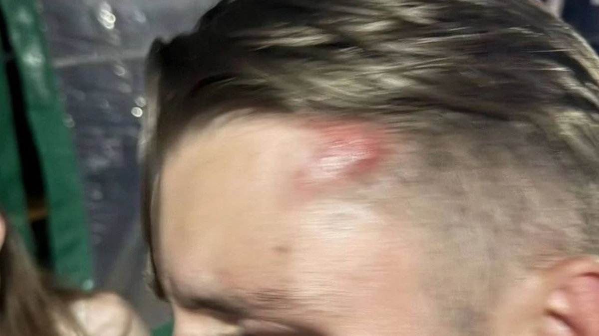 Deutscher in Pattaya attackiert – Holländer in Phuket verletzt