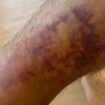 Indischer Tourist in Pattaya attackiert