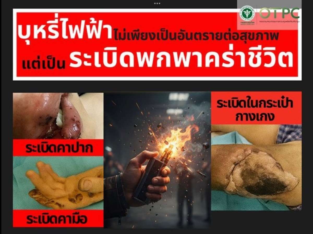 Behörde warnt: E-Zigaretten sind „tragbare Bomben“