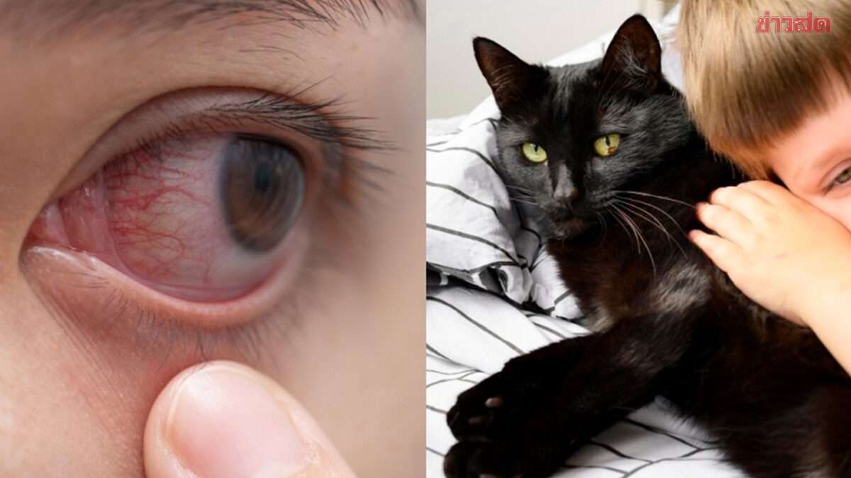 Junge fast blind nach Katzen-Parasiten