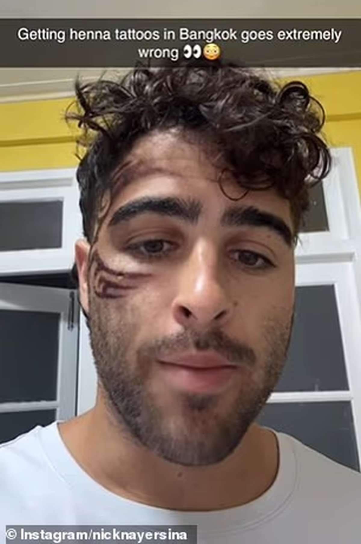 Nach Tattoo Gesicht verbrannt – Warnung an Bangkok-Reisende