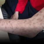 HIV-Infektionen bei Thailands Jugend steigen – Ministerium reagiert