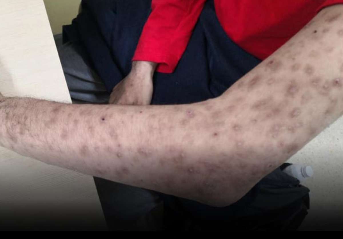 HIV-Infektionen bei Thailands Jugend steigen – Ministerium reagiert